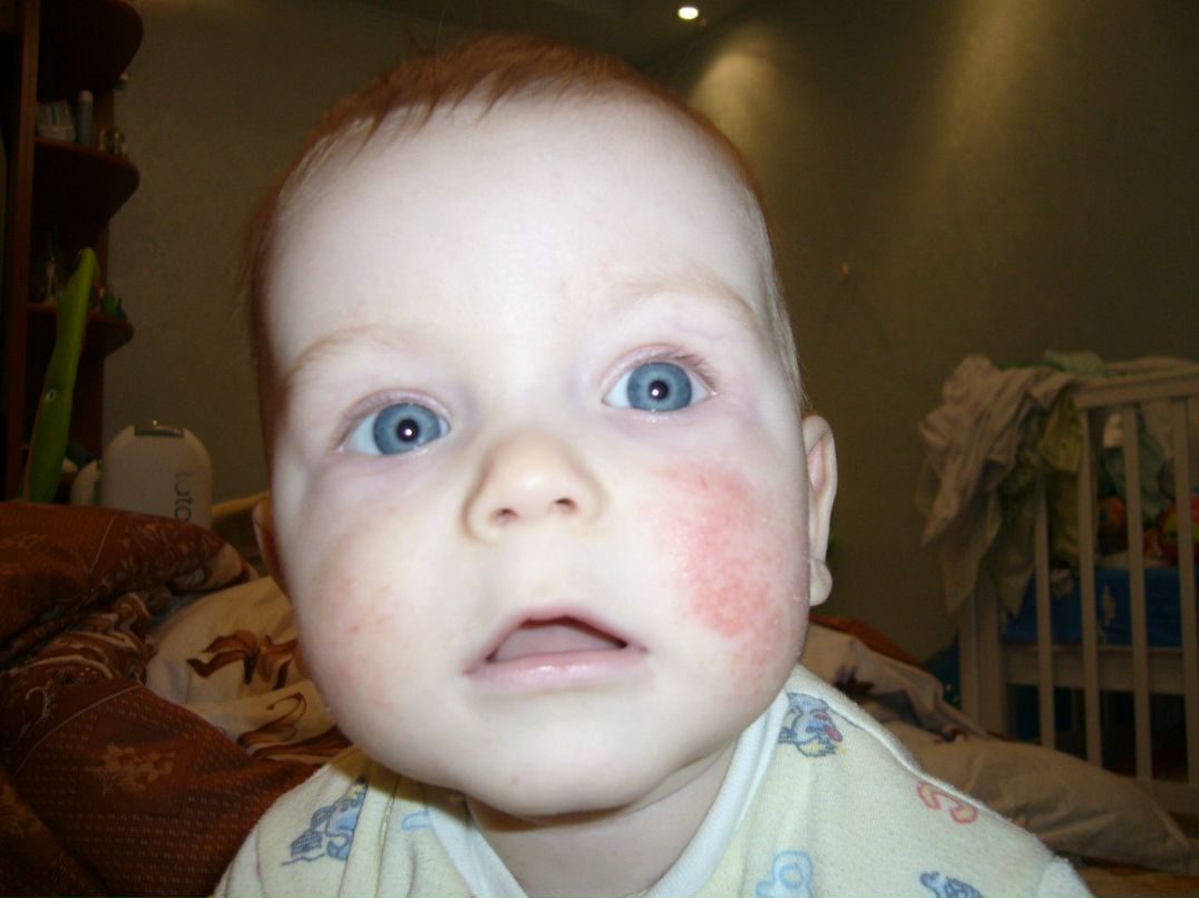 Игорь Филоненко фотография #6